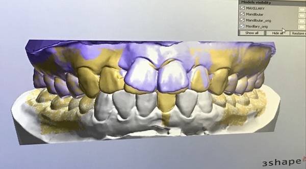 歯科医院HPのSEOを意識したブログの提案