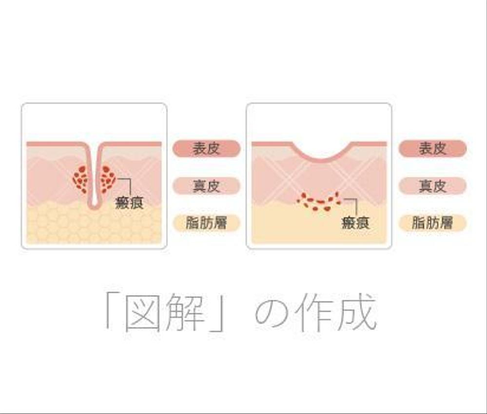 簡単な説明図イラスト制作を行います