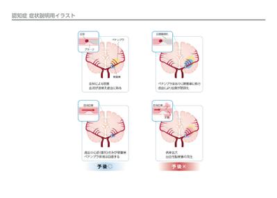 認知症 患者向け資材イラスト