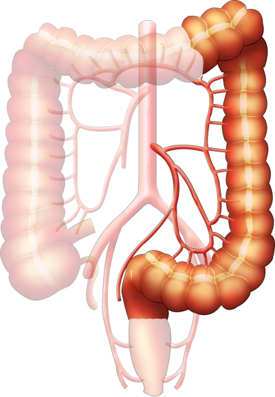 人の大腸の後半部分-IMA-