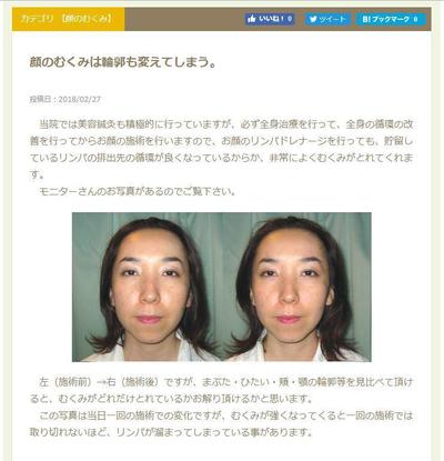 美容鍼灸に関するコラム記事作成