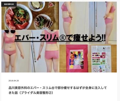 品川美容外科「エバースリム®︎」の体験取材記事