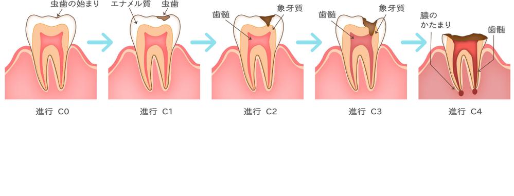 歯科治療