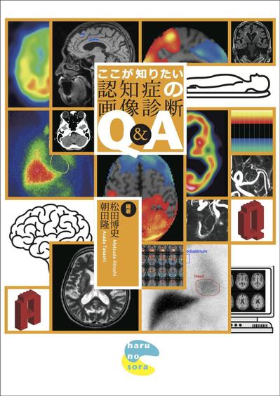 【書籍】ここが知りたい認知症の画像診断Q&amp;A