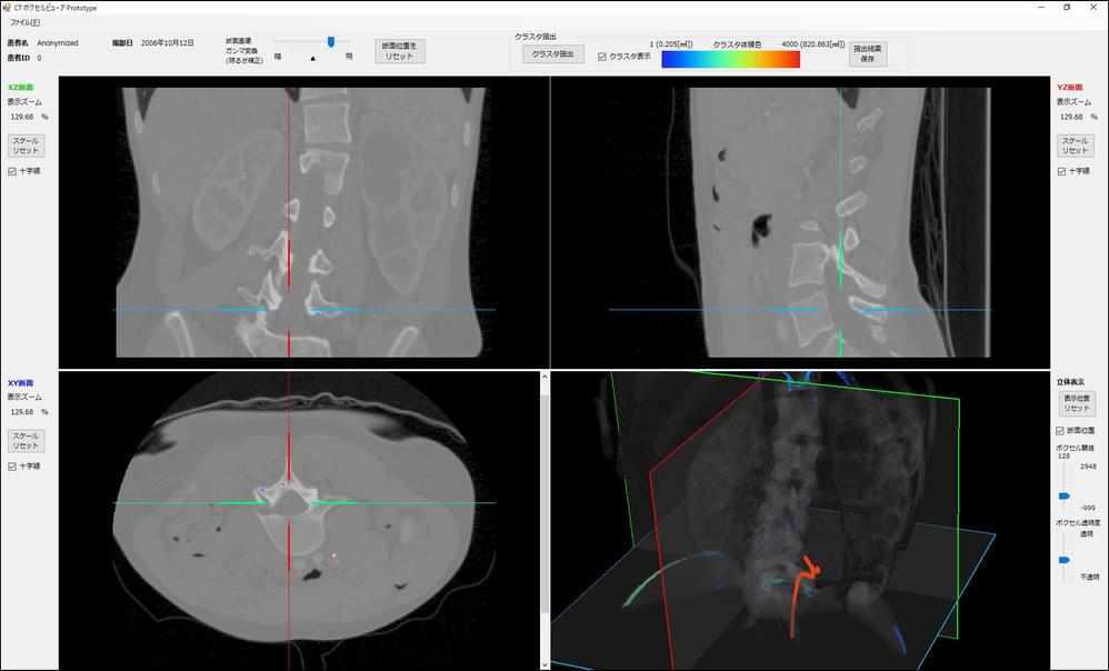 医療用／製品検査用CTボリュームレンダリング