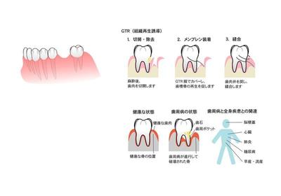 イラスト