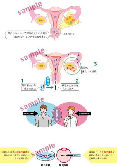 クリニックサイトのイラスト（不妊症）