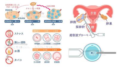 不妊治療の情報サイト用イラスト