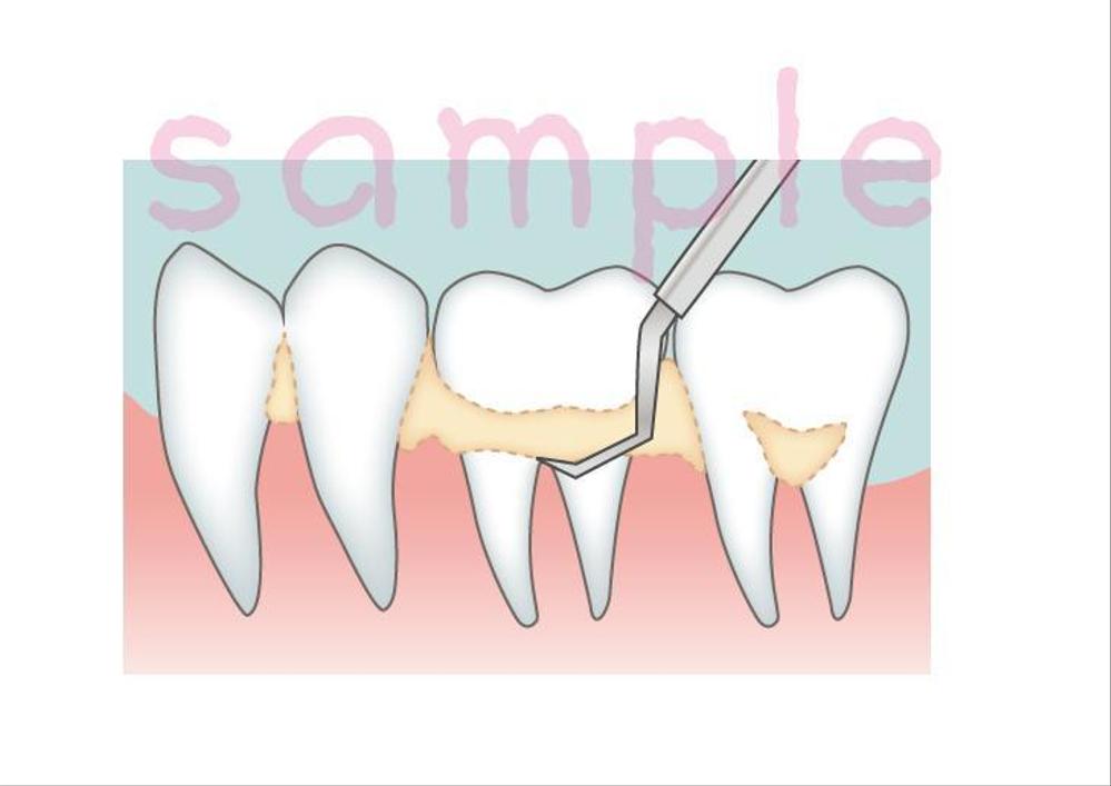 歯科医院サイト使用のイラスト