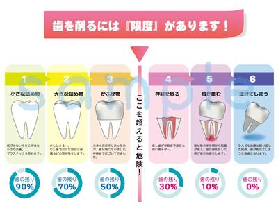 歯科治療説明図