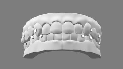 広告用歯の３Dモデリング