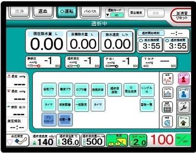 透析監視装置の画面