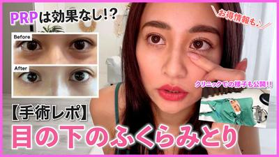 【美容整形手術密着動画】の企画、動画編集、サムネイル作成