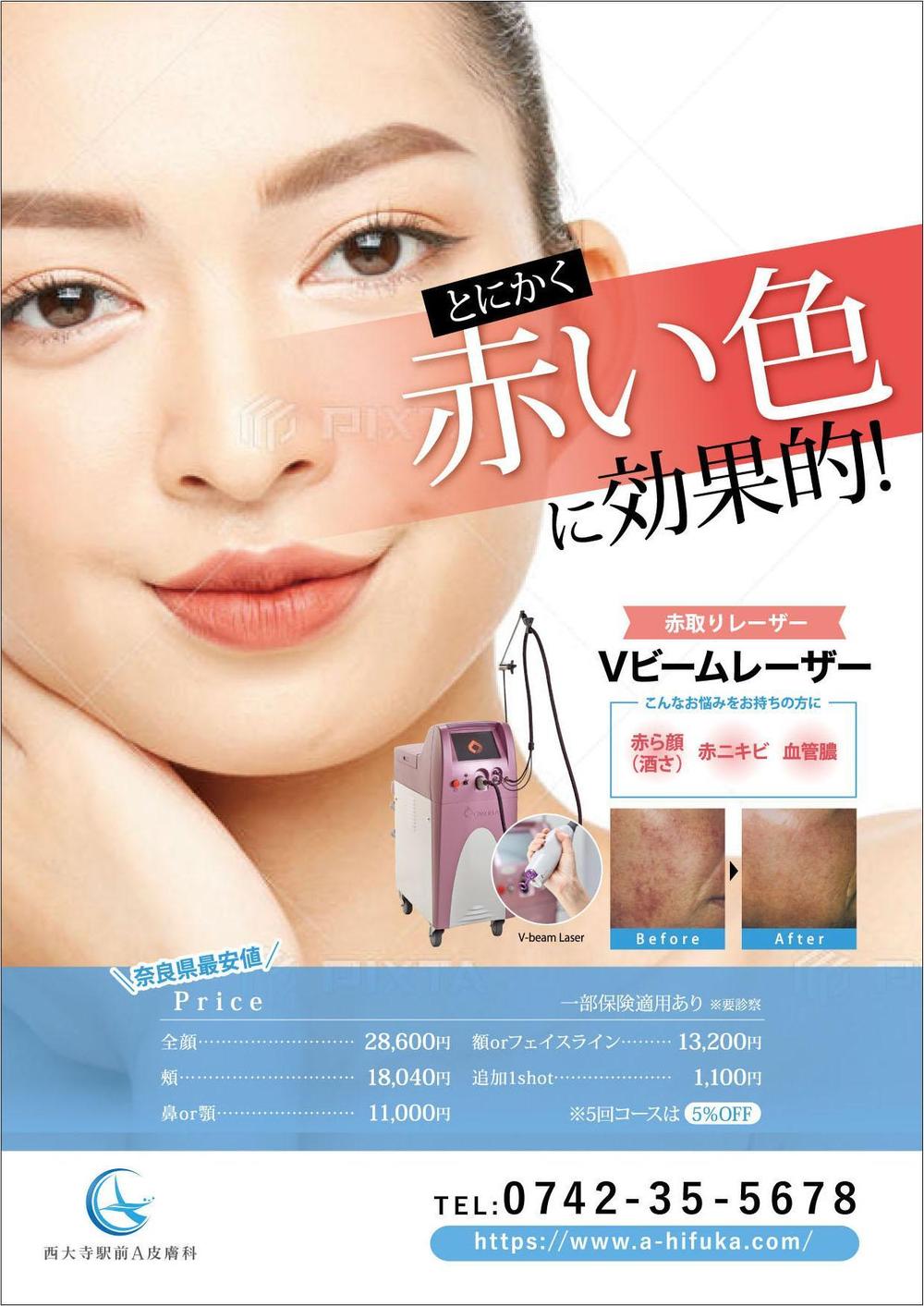 美容皮膚科の院内掲示用ポスター