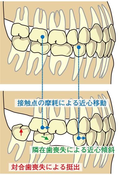 イラスト3
