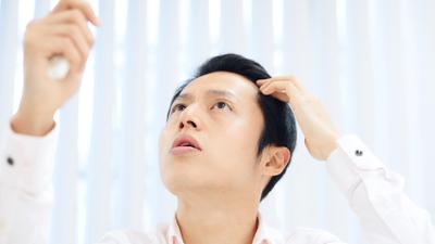 AGA治療SEO【医療広告ガイドライン対応】AGA・皮膚科クリニック向け記事を英語論文に基づき執筆しました