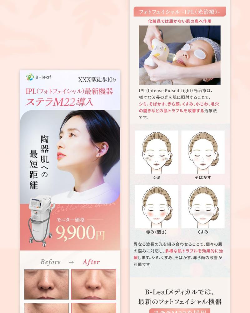 美容クリニックのフェイシャル用LPを制作しました