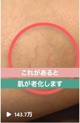 鍼灸院の院長のトークリールを編集しました