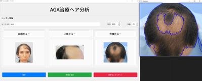 1ました