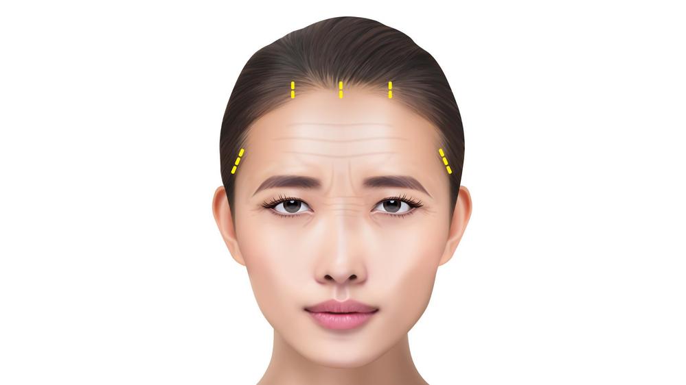 「まぶたとなみだのクリニック千葉」様の患者様向けCGを制作しました