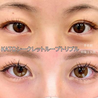 美容クリニックの施術の紹介をしました