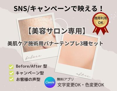 美肌ケア集客UP！Canvaで簡単編集SNS広告テンプレート制作しました