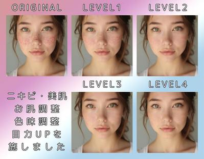 ニキビ・美肌・お肌調整・色味調整・目力UPを施しました