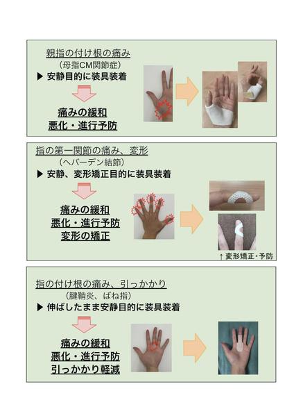リハビリの経験を活かし、症状の治療や対処法、予防医療などの知識を中心に提供します
