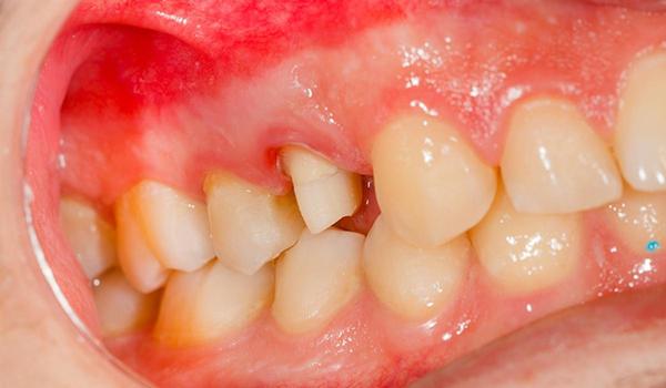 医療歯科・歯科医院に関する専門的知識・治療方法などの執筆を承ります