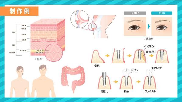 【医療用】分かりやすい！伝わる！図解・説明用イラスト制作します！ます