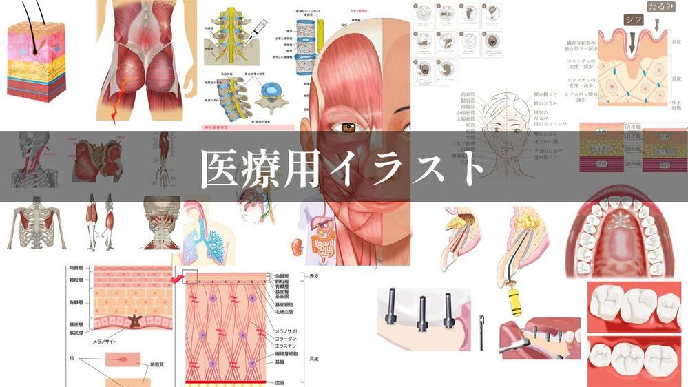 医療用イラスト作成いたします クラウドソーシング ランサーズ