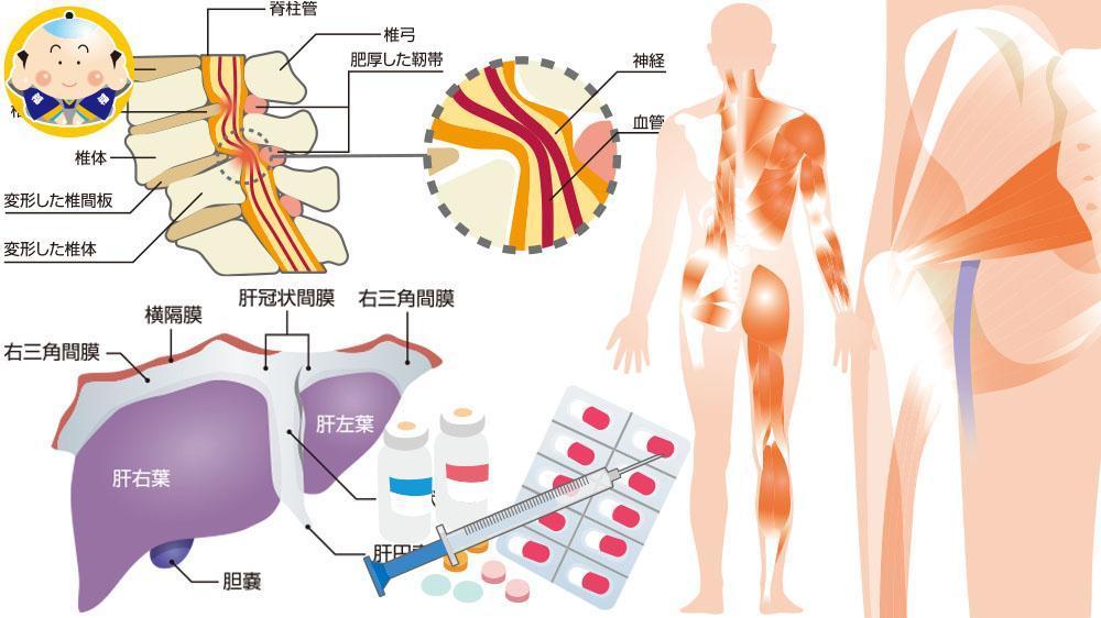 温かく優しい、医療、健康、介護や福祉のイラスト、@3,500円〜お描きします