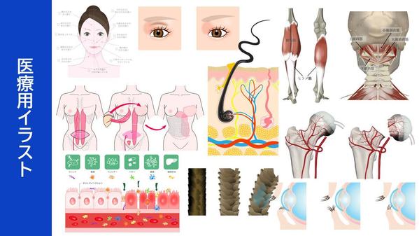 シンプルなものからリアルタッチなものまで様々なスタイルで医療用イラスト作成いたします