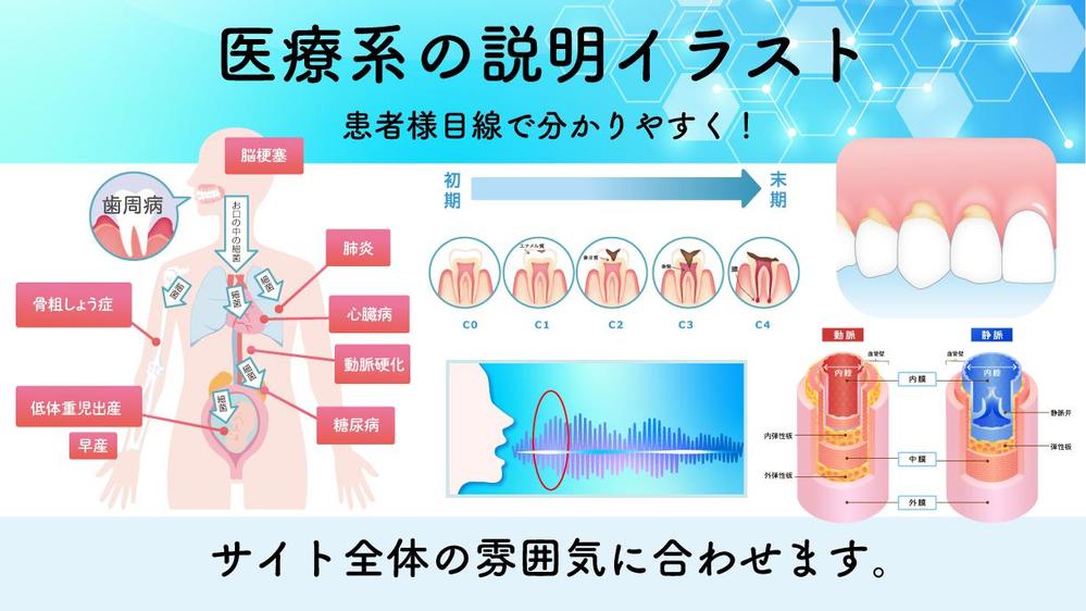 サイトや冊子に使えるオリジナルの医療系のキレイな説明図作成します ランサーズ