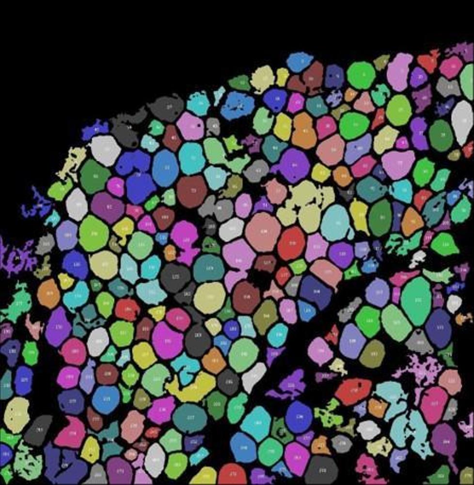 難易度の高い深層学習ＡＩメソッドを開発して実装をします
