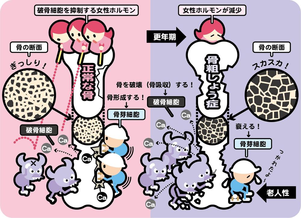 わかりやすいイラスト説明図を作成します！