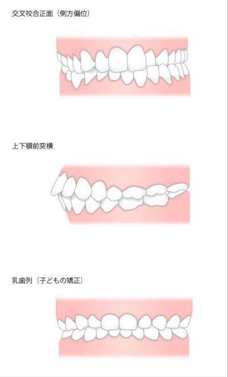 Seiwaさんの事例 実績 提案 Hp パンフ用 歯並び 噛み合わせのイラスト作成依頼12点 Smile M様初め クラウドソーシング ランサーズ