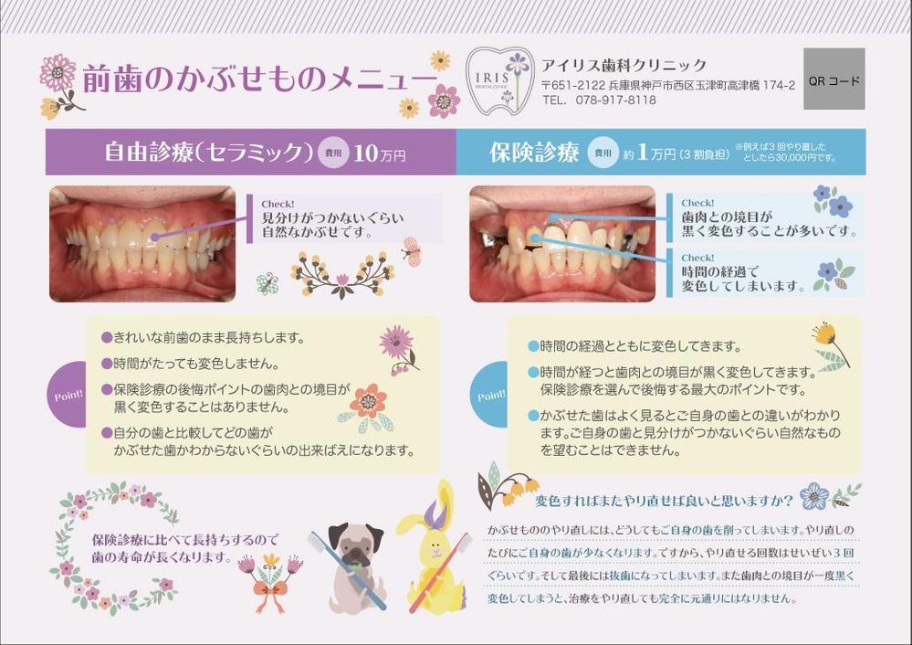 歯科クリニックの自費治療説明メニューのチラシ