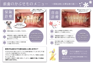 えんがわ (engawa-neko)さんの歯科クリニックの自費治療説明メニューのチラシへの提案