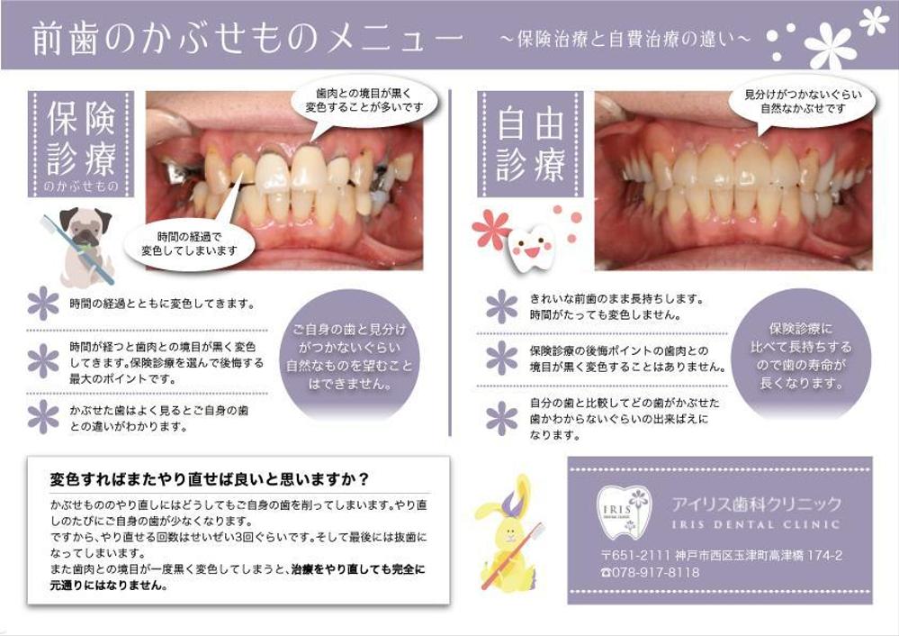 自費治療説明チラシ.jpg