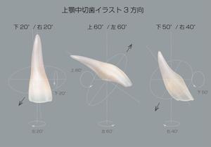 wood_moons (wood_moons)さんの歯のリアル画像の作成への提案