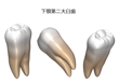 下顎第大臼歯−２.jpg