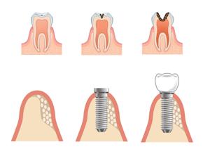 naomi (Ts-naomi)さんの歯医者のホームページで使用する、歯のイラスト制作のお願いへの提案