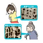 冷え田やっこ (srhdbk0220)さんの骨粗鬆症イラストの書き直しへの提案