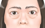 鈴丸 (suzumarushouten)さんの患者さんの顔写真のイラスト依頼への提案