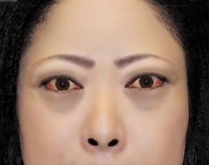 デザインオフイスkoike (syayuujinn)さんの患者さんの顔写真のイラスト依頼への提案
