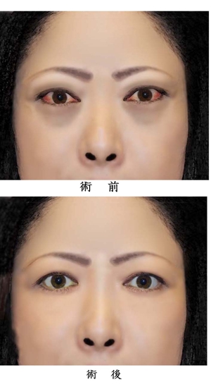 デザインオフイスkoike (syayuujinn)さんの患者さんの顔写真のイラスト依頼への提案