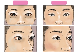 komi ちゃん (djkomi)さんの患者さんの顔写真のイラスト依頼への提案