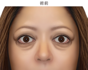 naomi (Ts-naomi)さんの患者さんの顔写真のイラスト依頼への提案