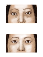 Nakayama Takao ()さんの患者さんの顔写真のイラスト依頼への提案